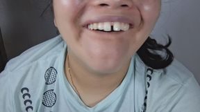 “Yellow Teeth Close-Up: Imperfect Smile Fetish”