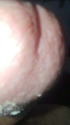 Smegma Big Uncut Smell