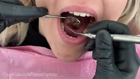 Dental Cleaning - Full Mouth and Permanent Retainer