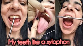 My teeth sound like a xylophone !