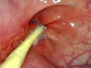 EXTREME ANAL POV. CAMERA INSIDE HER ASSHOLE AS I POUND HER WITH MY BIG COCK AND CUM DEEP INSIDE