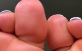 Wrinkly Toes up-close