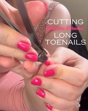 Overgrown toenail cutting