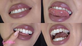 Aligner progress & updates #2 ~ Sweet Maria