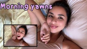Morning yawns