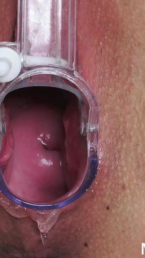 Horny Blonde with Big Meaty Pussy Fingered by Doctor