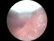 Extreme Urethra Close Up/CUMMING