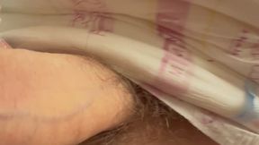 SAFS plaster cast, Hot moments