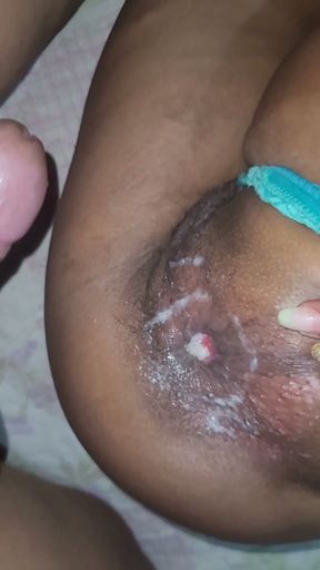 Prolapso Anal Big Gape ass   Clip 1