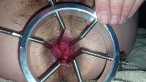 Speculum Spreads Hole Wide Open. Juicy And Sloppy