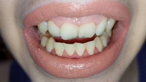 teeth tour - admire my teeth