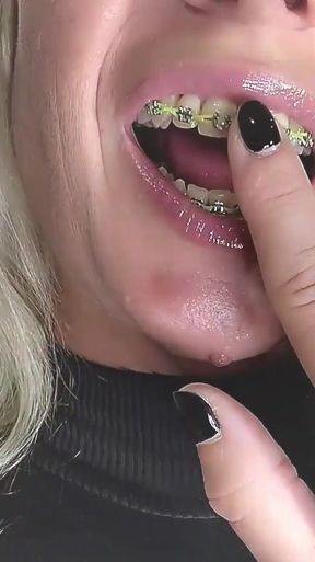 Licking and Sucking My Metal Braces