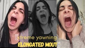 Yawning big and contagious