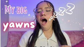 MY BIG YAWNS