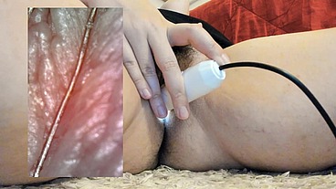 Extreme vore compilation - Extreme vaginal endoscopy orgasm