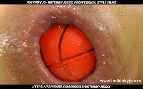 Santas Balls Fun &amp; Anal Prolapse by Hotkinkyjo