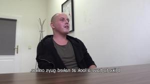 Bald teen got slammed to pay for his debts