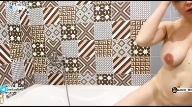 My girlfriend's mom has spring vitamin deficiency