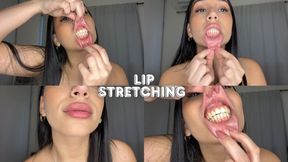 Lower lip lift with gloss