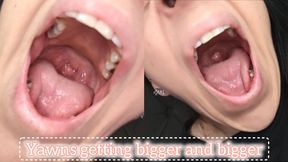 Yawns getting bigger and bigger