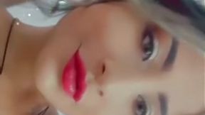 Kiss