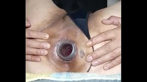 Analmente - Cogi&eacute_ndome profundo. update #5 - 1000146487 - Oct 25, 2024