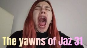 The yawns of Jaz 31