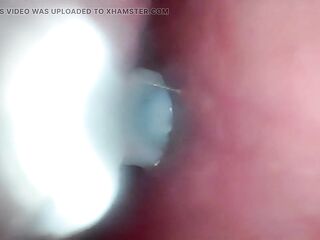 Semen in Cervix Wide Stretching Cunt Endoscope!