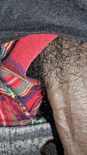 Close up on These Thick Veins