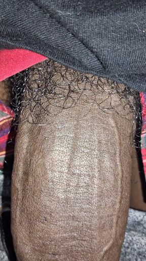 Close up on These Thick Veins