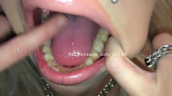 Vyxen Mouth