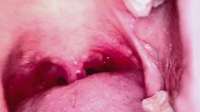 Sasha Endoscopic Mouth Tour