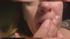 Herpes on my lip