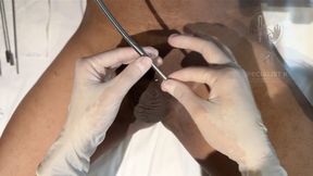 6mm Hegar Dilation & Systemic Calibration | Log 09: Solid-Core Urethral Displacement | Specialist K