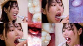 Yaya Kohaku - Observing Yaya's teeth, mouth, and back of the throat with a dental camera - MOV