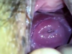 my japanese girlfend's cute cervix in huge hole