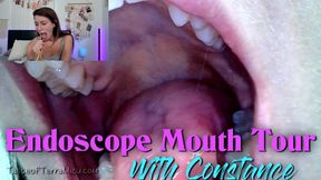 Endoscope Mouth Tour - Constance - HD 720 MP4