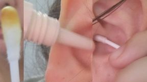 Close-Up Earwax Removal with Q-Tips – Intimate Ear Cleaning Session part 2