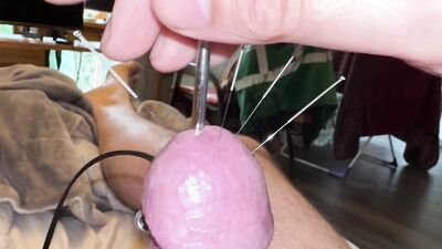 Estim and Acorn - Acupuncture!