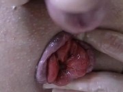 Teen fisting, prolapsing, cumming.