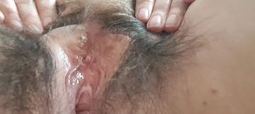 Small Clitoris and Puckered Vagina of Mature MILF