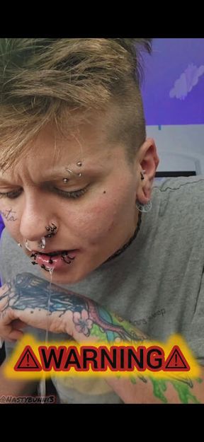 Removing SplitTongue Stitches