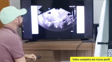 Wife cheats on husband with gynecologist during ultrasound exam!