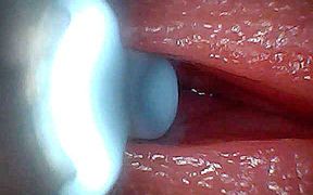 I Couldn’t Believe What Happens Inside the Penis as Sperm Passes Through (endoscopic Footage)