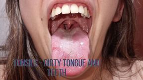 White tongue - dirty and yellow teeth - bad breath