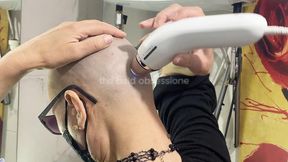 IPL LASER treatment