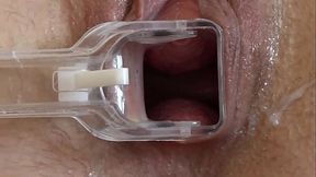 Cervix and gaping pussy close-up. Milf with gynecological speculum masturbates. Amateur medical fetish.