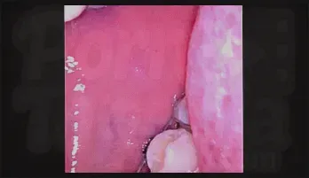 Submissive Seduction: Latina Braces - High-Octane HD Porn