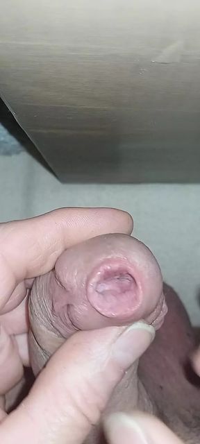 Urethral sounding