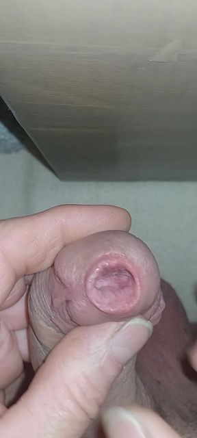 Urethral sounding